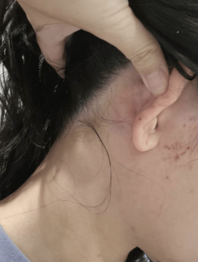 使馆回应中国女子在堪培拉遭陌生人殴打：要求澳警方彻查案件